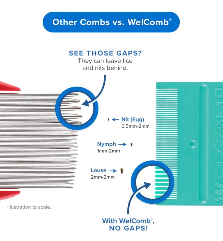 The Best Method To Get Rid of Lice